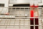 Teste de glicose sanguínea em cães e gatos vai ser mais preciso