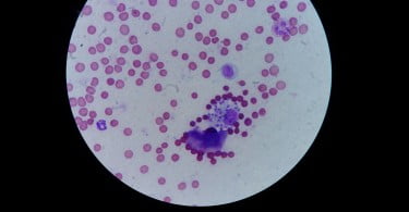 macrofago fagocitando amastigotes de leishmania