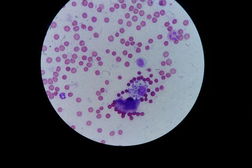 macrofago fagocitando amastigotes de leishmania