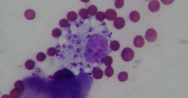 macrofago fagocitando amastogotes aumentado