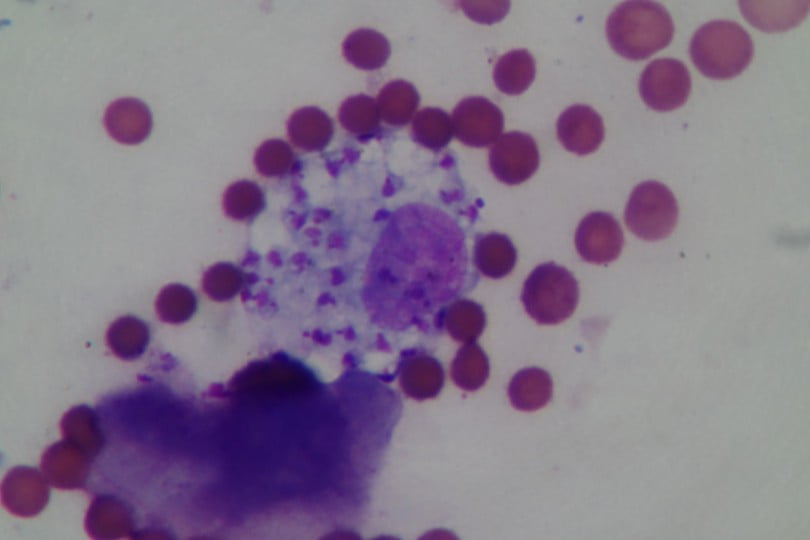 macrofago fagocitando amastogotes aumentado