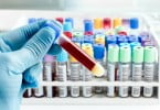 amostras de sangue
