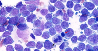 linfoma canino GeneVet Veterinária Atual