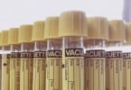 Tubos recolha urina laboratório Inno Veterinária Atual