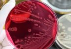 Infeções com bactérias de origem alimentar cada vez mais difíceis de tratar