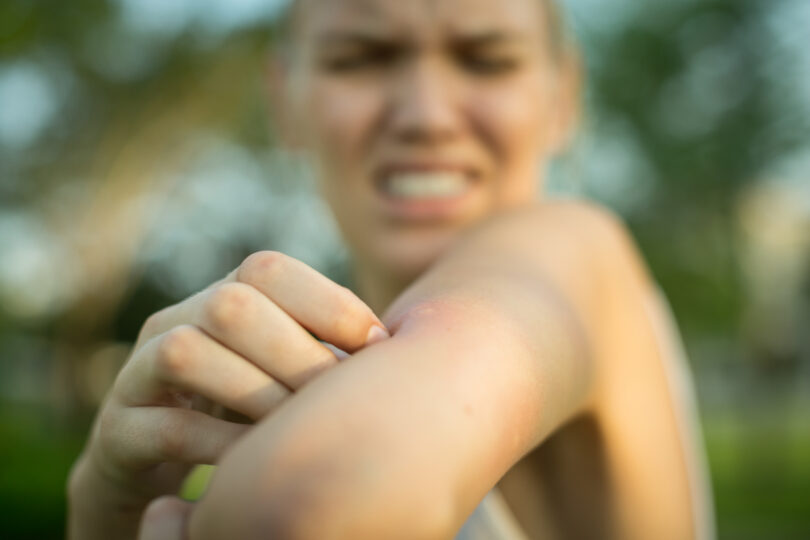 Atividades humanas podem promover propagação de mosquitos disseminadores de doenças