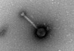 - Fago especifico de Staphylococcus sp. visualizado por microscopia eletrónica de transmissão.