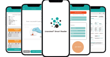 Campifarma disponibiliza app Uranotest Smart Reader