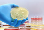 Alimentos crus podem conter bactérias resistentes a antibióticos