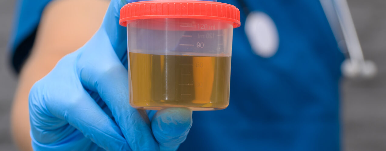 Novo teste urinário pode facilitar diagnóstico de doenças caninas, indica estudo