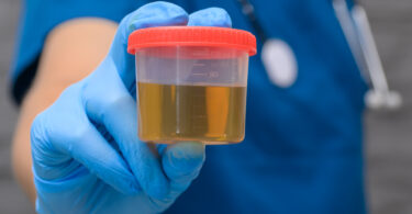 Novo teste urinário pode facilitar diagnóstico de doenças caninas, indica estudo